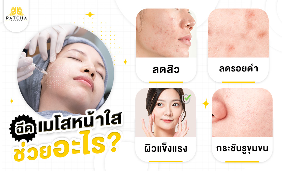 เมโสหน้าใสช่วยอะไร