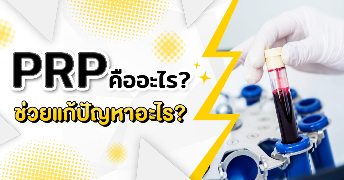 PRP คืออะไร ช่วยเรื่องอะไรได้บ้าง มีขั้นตอนการทำอย่างไร