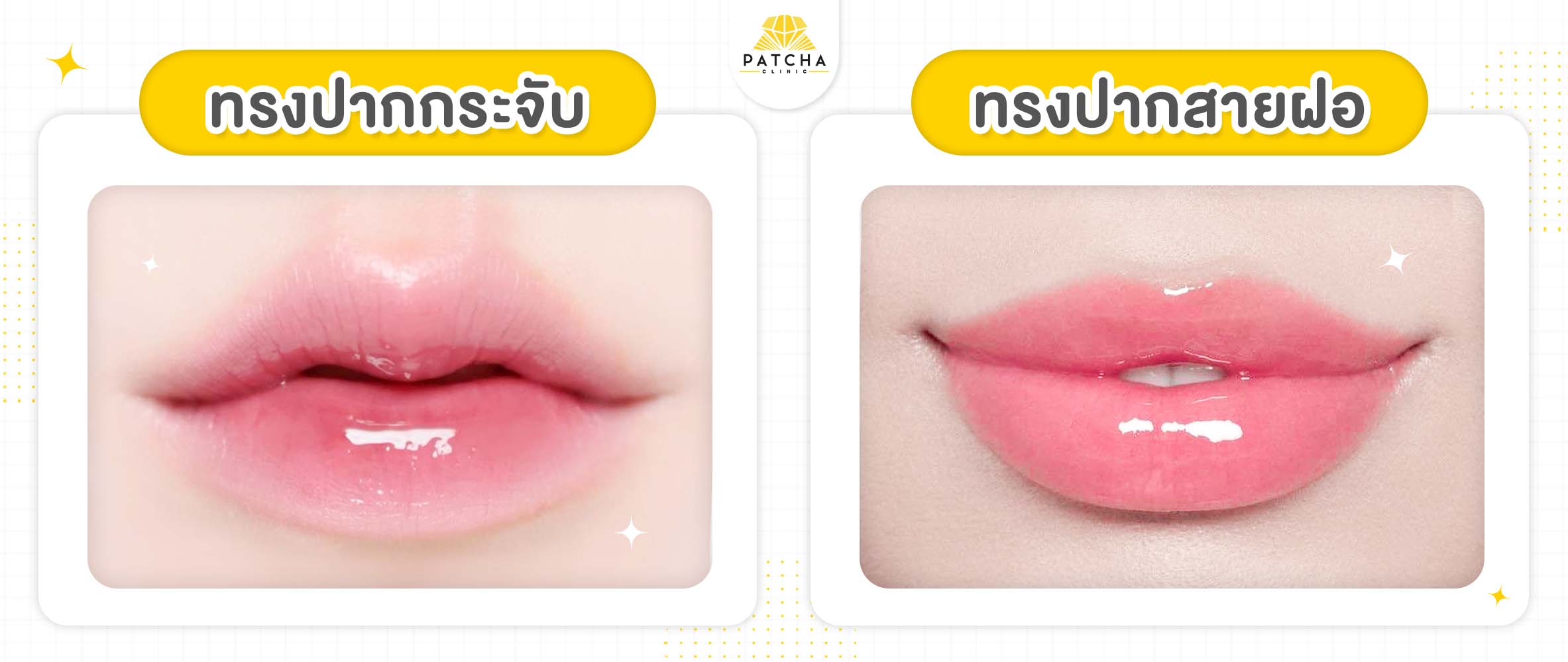 ทรงปากที่นิยม