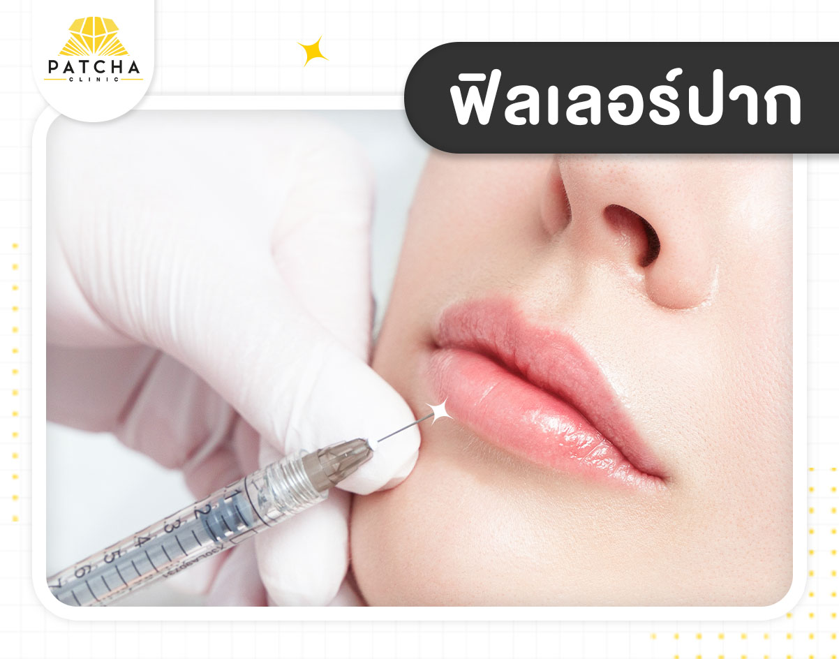 lip-filler ฉีดฟิลเลอร์ปาก