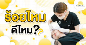 ร้อยไหมดีไหม