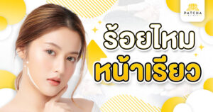 ร้อยไหมหน้าเรียว