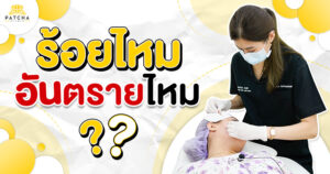 ร้อยไหมอันตรายไหม