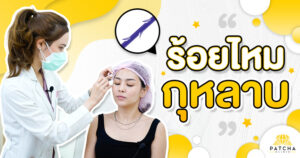 ร้อยไหมกุหลาบ