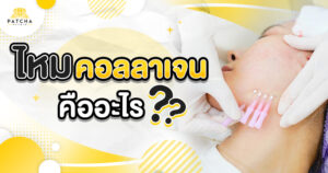 ร้อยไหมคอลลาเจน