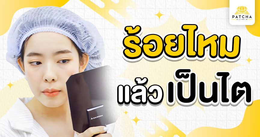 ร้อยไหมแล้วเป็นไต