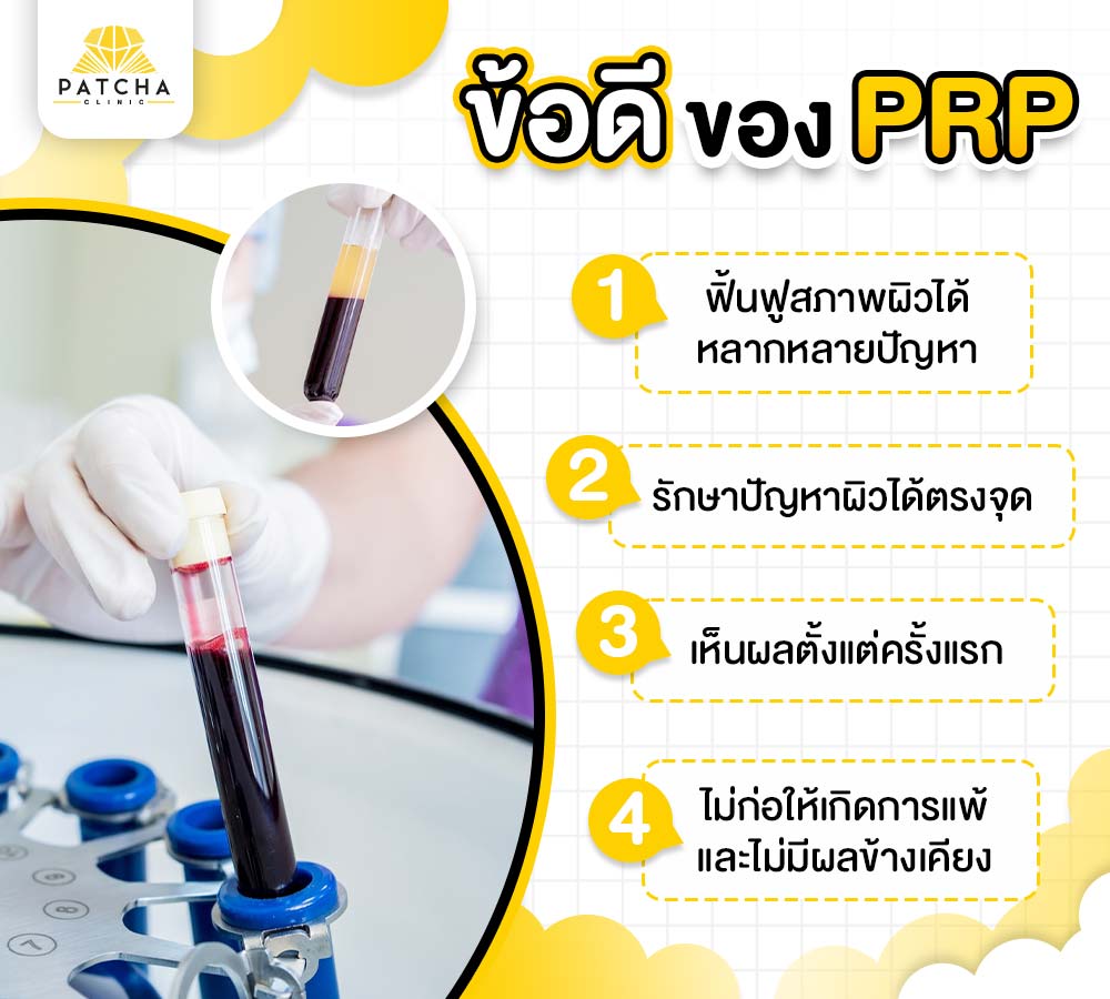 PRP คืออะไร ช่วยเรื่องอะไรได้บ้าง มีขั้นตอนการทำอย่างไร
