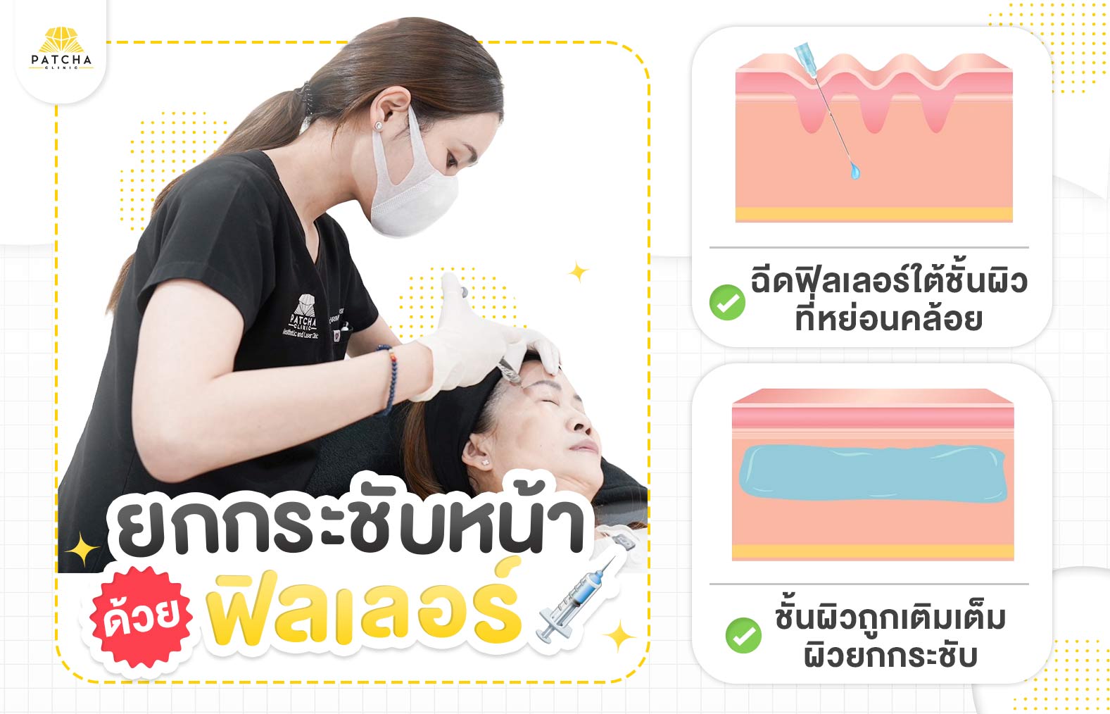 ฟิลเลอร์ยกกระชับหน้า