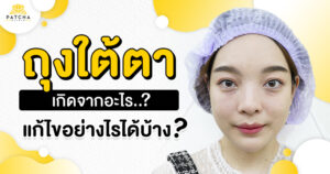 ถุงใต้ตา