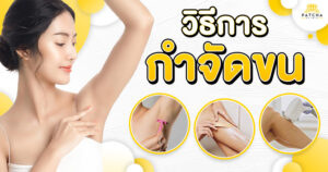 วิธีกำจัดขน