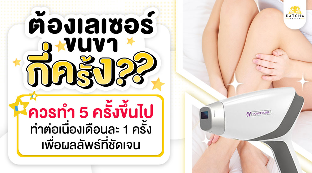เลเซอร์ขนขากี่ครั้งเห็นผล