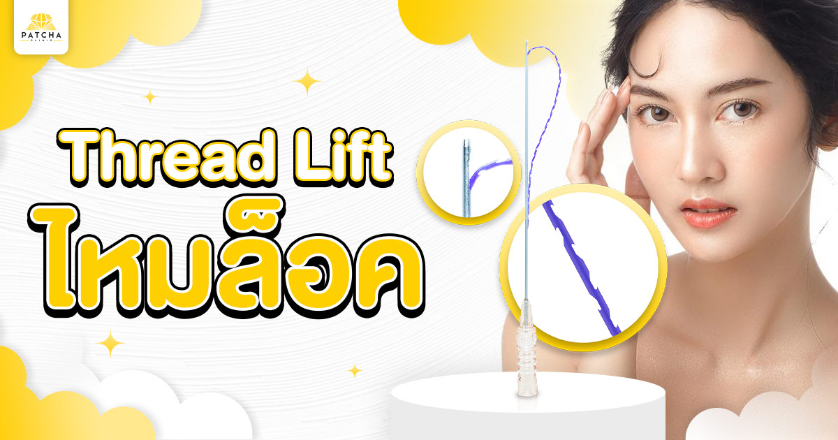 ไหมล็อค คืออะไร แตกต่างจากไหมชนิดอื่นอย่างไร
