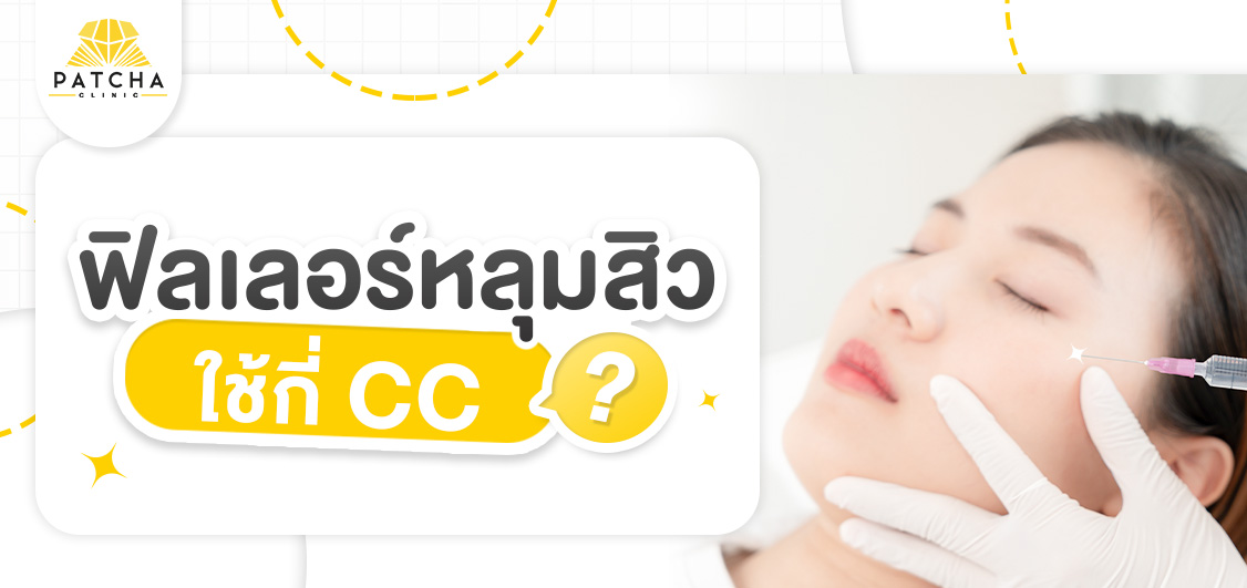 ฟิลเลอร์หลุมสิวใช้กี่ cc