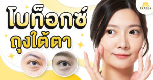 โบท็อกซ์ถุงใต้ตา