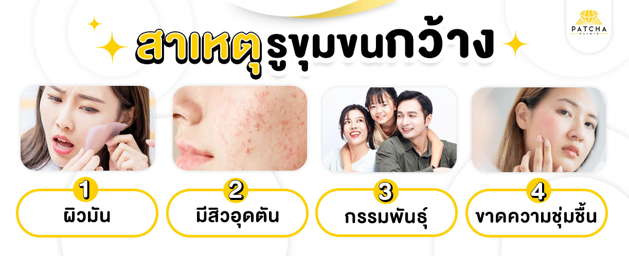 สาเหตุรูขุมขนกว้าง