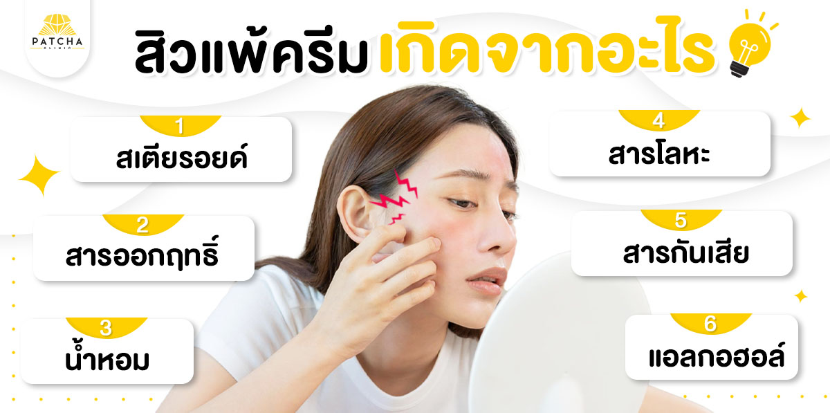 สิวแพ้ครีมเกิดจาก