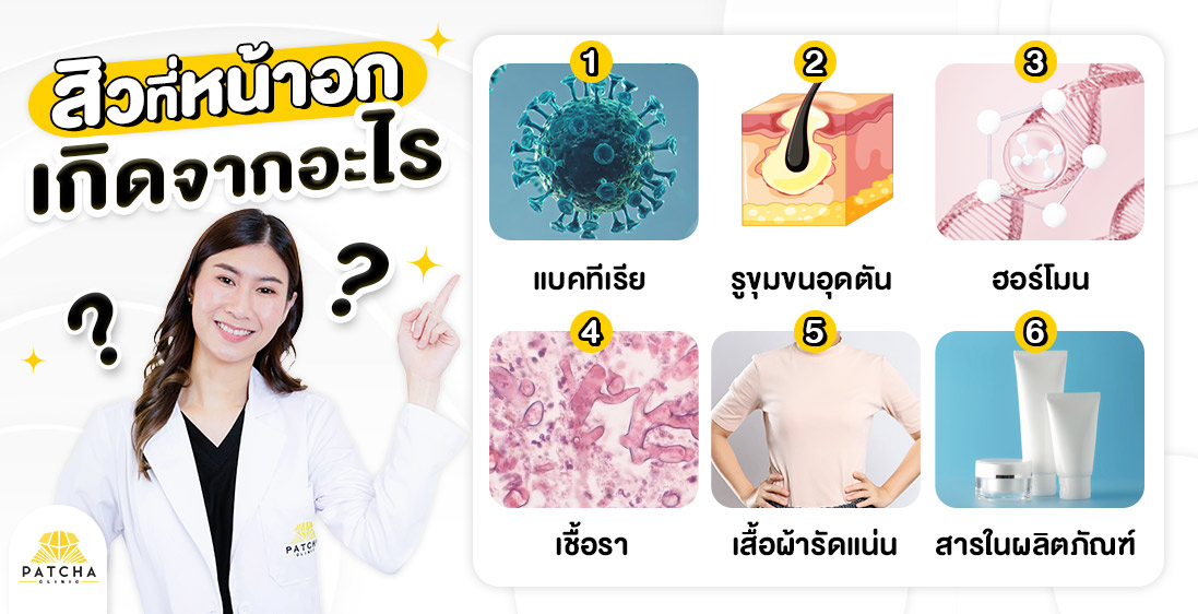 สิวที่หน้าอกเกิดจากอะไร