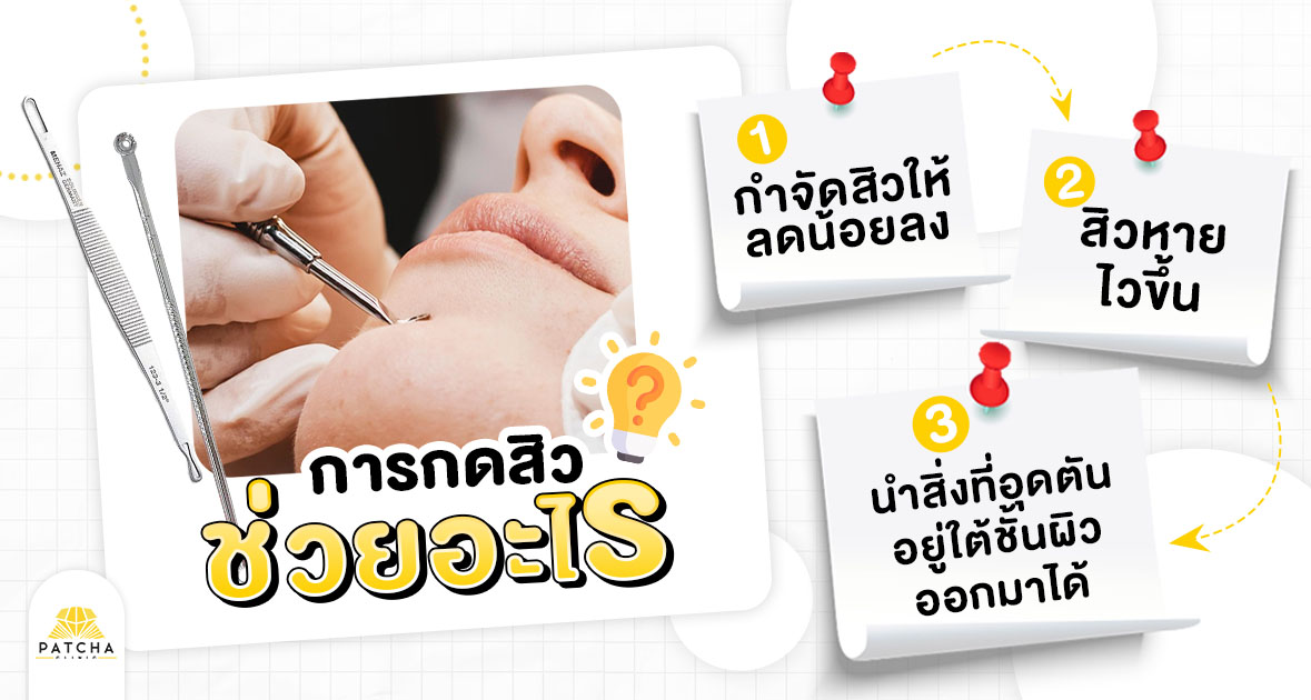 กดสิวช่วยอะไร