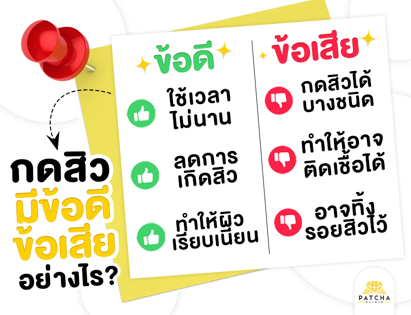 ข้อดี ข้อเสียกดสิว