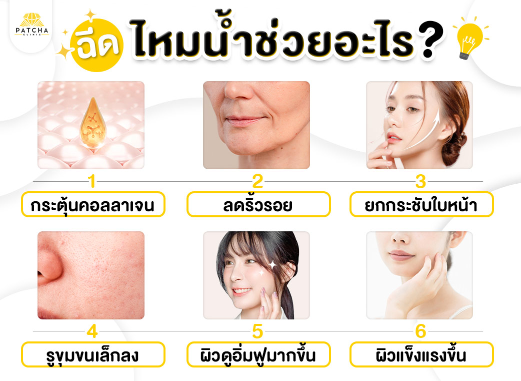 ไหมน้ำช่วยอะไร