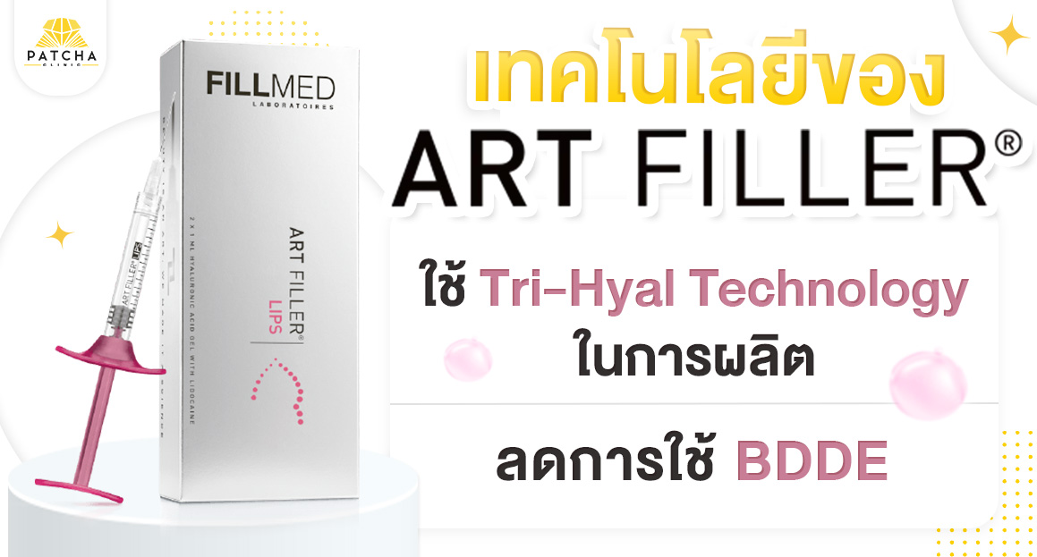 เทคโนโลยี art filler