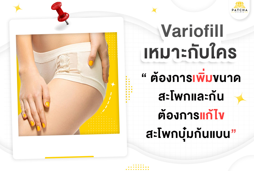 ฟิลเลอร์ variofill เหมาะกับใคร