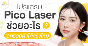 Pico Laser ช่วยอะไร