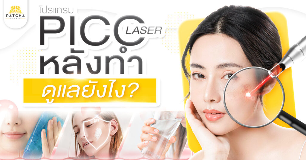 Pico Laser หลังทำดูแลยังไง