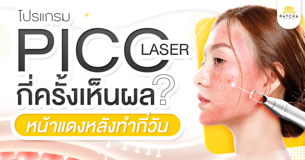 Pico Laser กี่ครั้งเห็นผล